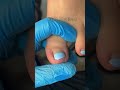 Satisfying Toenail Grooming | Gentle Foot Care Routine #fypシ #cleannails #RelaxingCare #fypシ