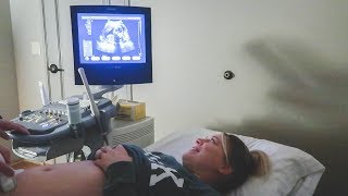 Seeing Our Baby At 17 Weeks Pregnant!!! Seeing Our Baby At 17 Weeks Pregnant!!!