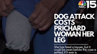 Seeking help: Dog attack costs Prichard woman her leg - NBC 15 WPMI