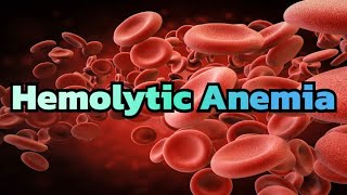 Hemolytic Anemia (updated 2023)  CRASH! Medical Review Series