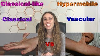 Differences Between cEDS, clEDS, vEDS, and hEDS | Ehlers Danlos Types