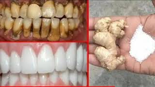 blanchissement des dents وصفة طبيعية لتبييض الاسنان