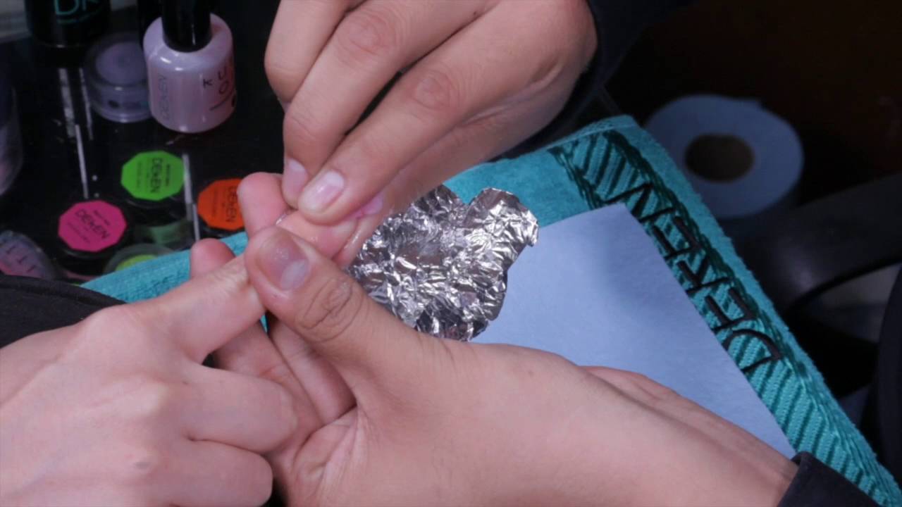 Remoción de DKN GEL con Remover K