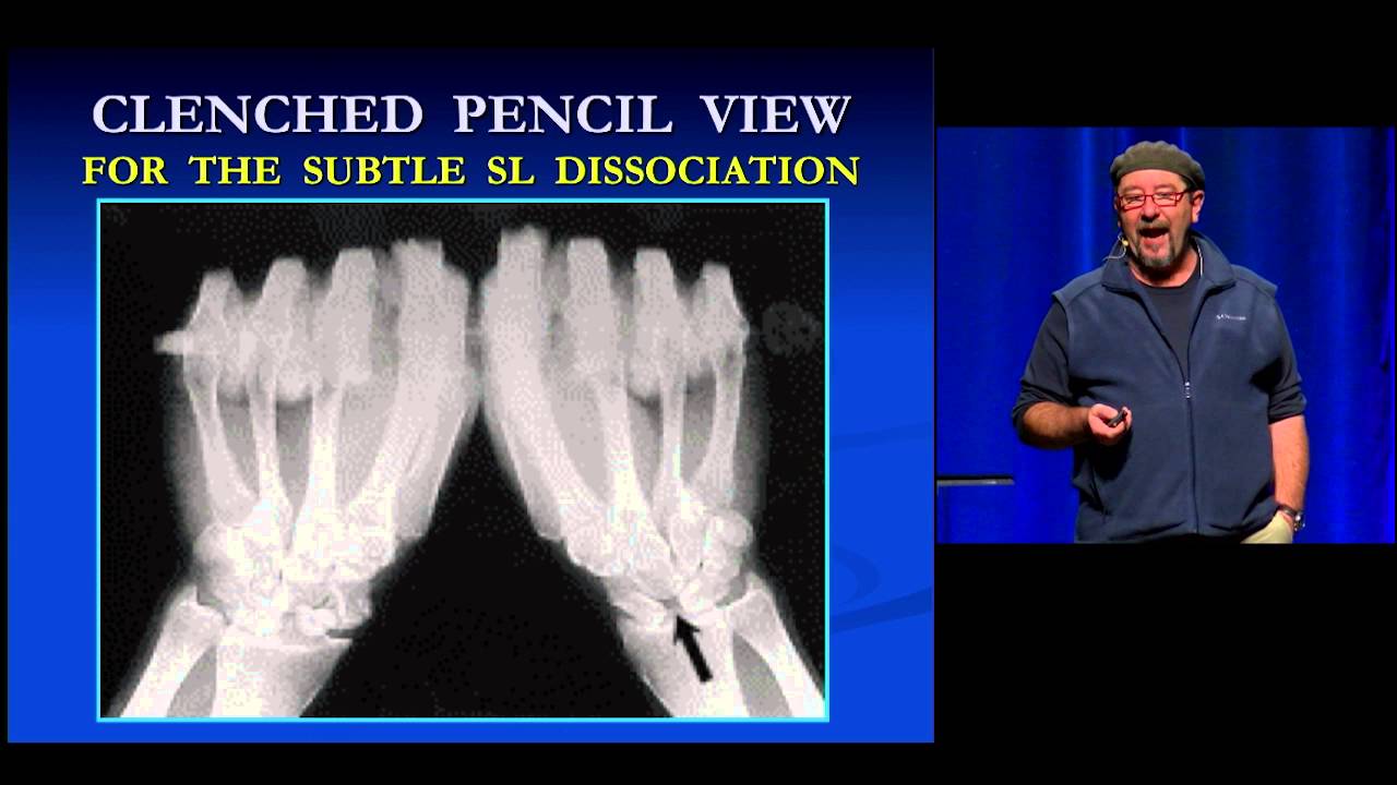 EEM 2015 And 1 Xray views to detect occult injuries YouTube