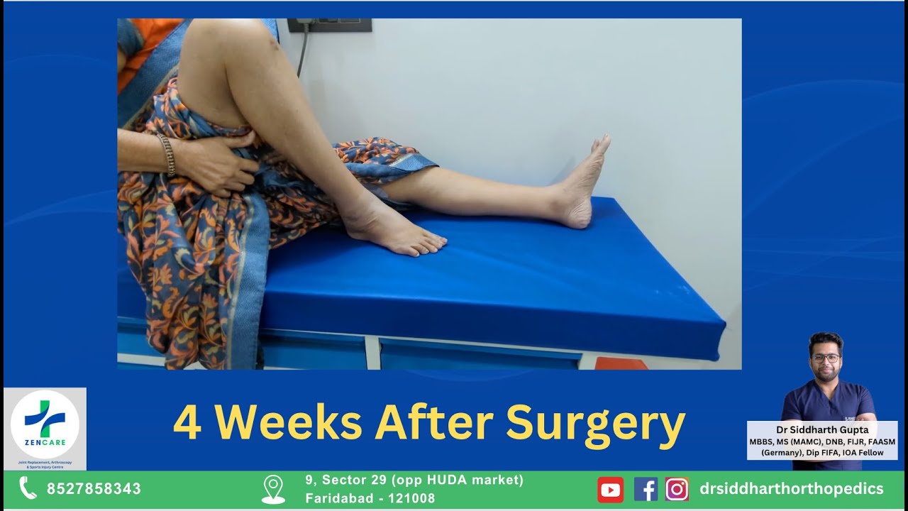 Knee Bending 4 weeks after Total Knee Replacement - YouTube
