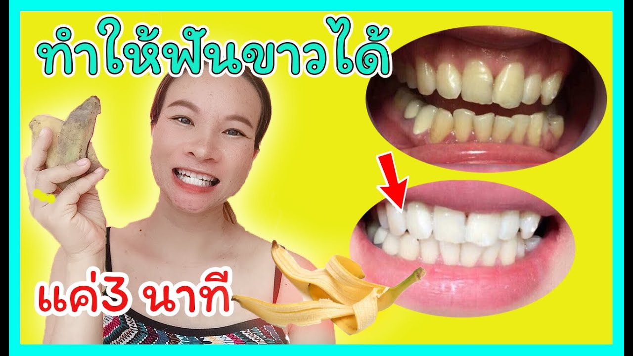 ฟันเหลือง ทำให้ฟันขาวได้แค่วันละ 3 นาที  How To Whiten Your Yellow Teeth Naturally