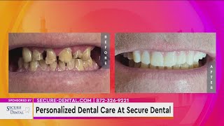 Personalized Dental Care At Secure Dental
