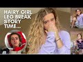 Horrifying leg break story  hairy leg tiktok girl