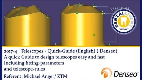 ENGLISH -NEW EXOCAD TUTORIAL DENSEO 2017-4 - Telescopes - Quick-Guide  (English)-PREVIEW VIDEO