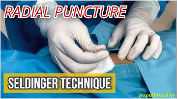 Radial puncture with Seldinger technique - tutorial - coronary angiography