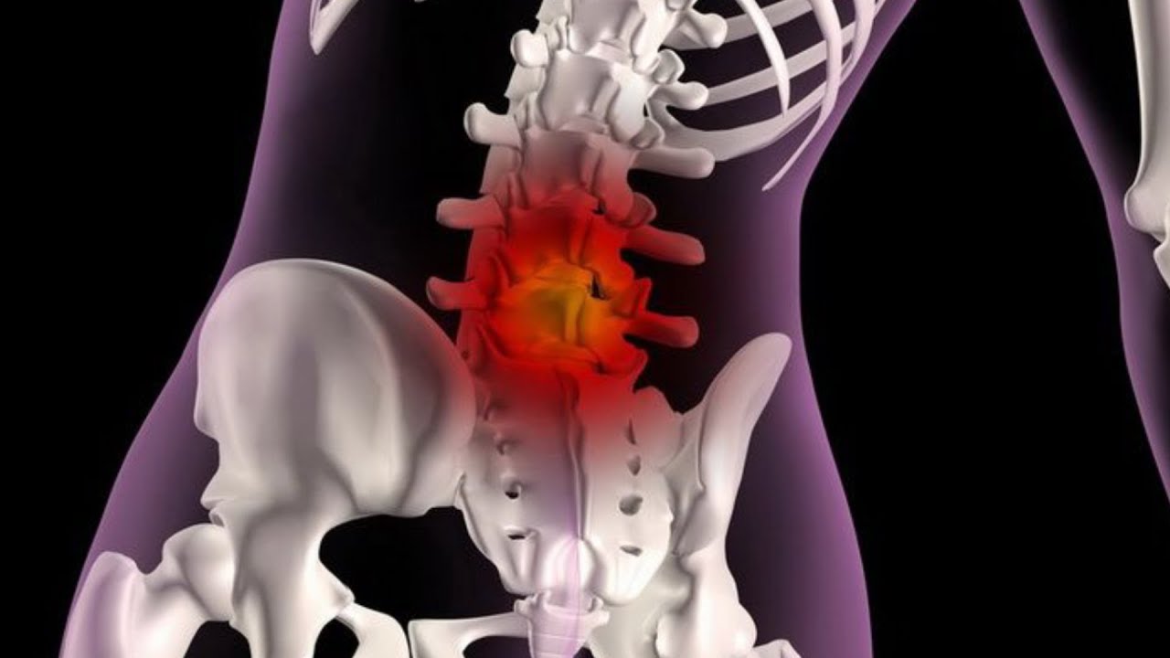 Грыжа поясничного отдела лечение у мужчин симптомы