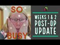 Weight Loss Surgery Post-Op, Weeks 1 & 2 Update | My Gastric Bypass Journey