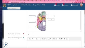 COMO HACER PREGUNTAS EN MOODLE CON IMÁGENES Y TIPO TEST