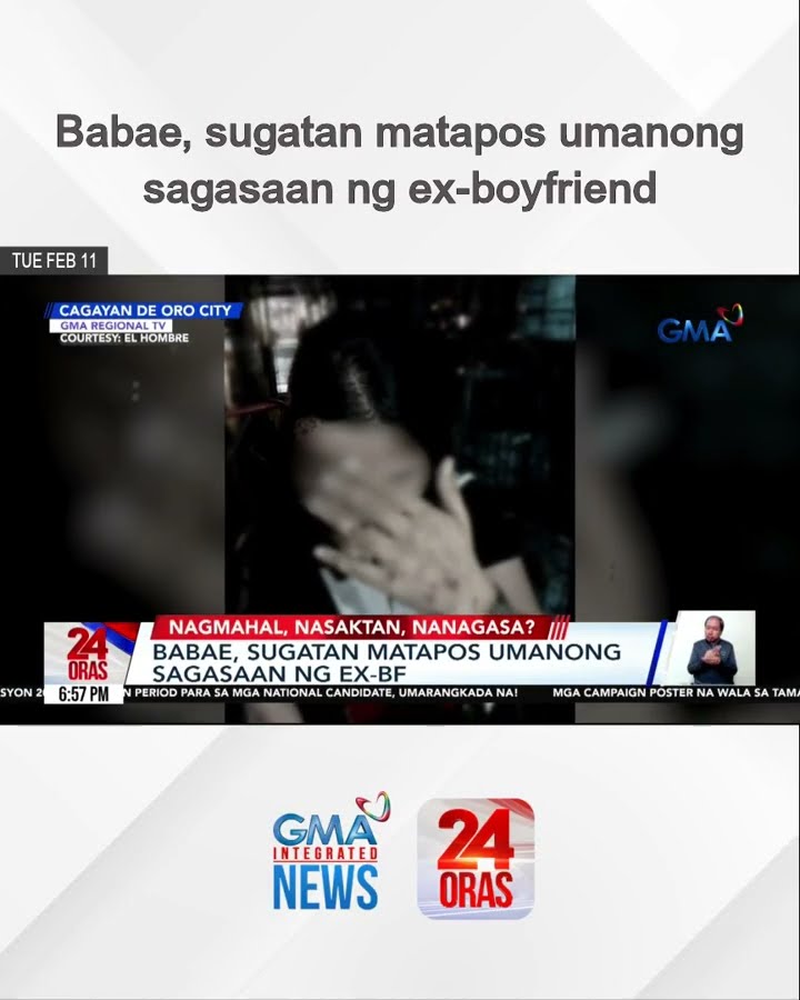 Babae, sugatan matapos umanong sagasaan ng ex-boyfriend | 24 Oras