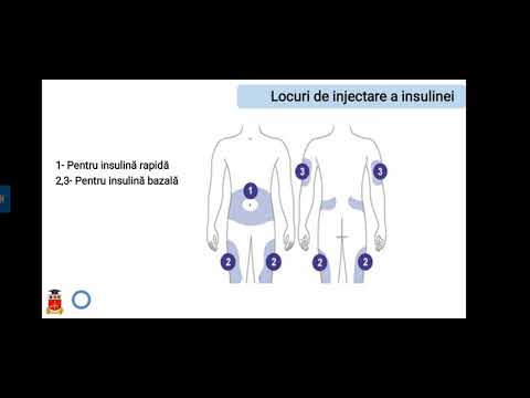 Video: Ambizom - Instrucțiuni De Utilizare, Indicații, Dozare, Analogi