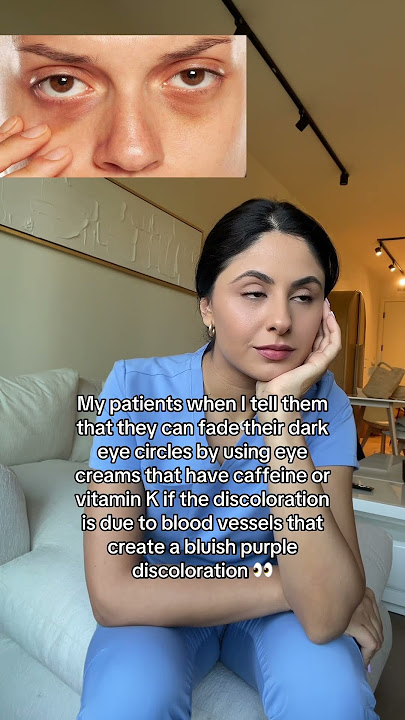 How to get rid of Dark Circles Under Eyes 👀