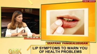 What your lips say about your health | Usapang Pangkalusugan screenshot 3