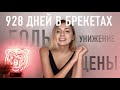 БРЕКЕТЫ: цены, выбор ортодонта и как с ними жить