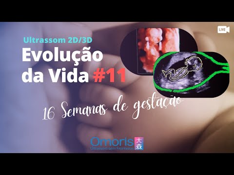 Pregnancy 16 weeks - Breastfeeding during pregnancy - Evolution of Life #11- OBSTETRIC ULTRASOUND
