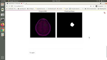 Brain MRI segmentation deployed application on streamlit