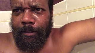 Celebrity Lui lepki cracked  yellowman (buster)in the face He is laying about cancer/which is cancer per c Net Worth