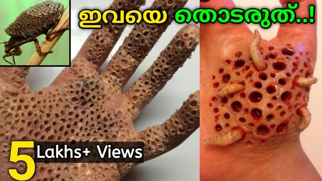 Download ലോകത്തിലെ ഏറ്റവും അപകടകാരികളായ പ്രാണികൾ | Most Dangerous Insects in the World | Fun&Facts Malayalam