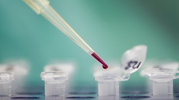 Circulating Epithelial Tumour Cells and Maintrac Methodology - Prof. Katharina Pachmann