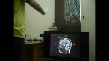 Hand Gesture Recognition for Browsing Medical Image