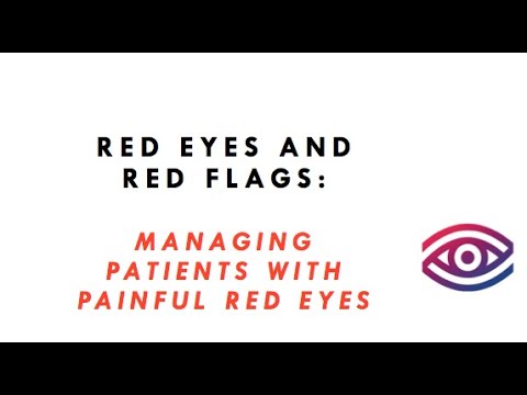 Red Eyes And Red Flags Part 1