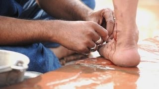 India's Roadside Clinic: Open Air Bloodletting