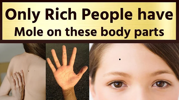 Only Rich People Have Mole on These Body Parts | Samudrik shastra - DayDayNews