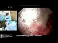 The Future of Endoscopy: AI &amp; Virtual Reality Explained
