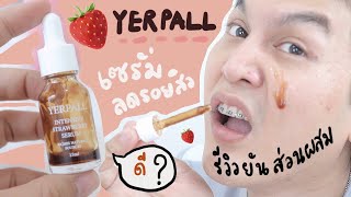 ♡ รีวิวตามคำขอ ” YERPALL เซรั่มสตอ 🍓 เซรั่มสตอเบอรี่ intensive strawberry serum ลดสิว ลดรอย | จบบ ♡