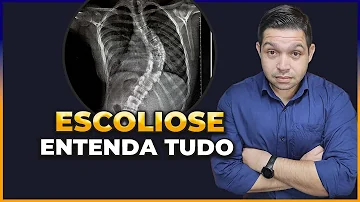 Qual o tratamento para escoliose na coluna?