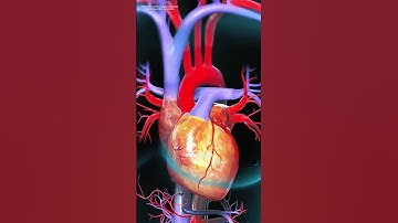 How Aortic Valve Replacement Surgery Is Performed? (3D animation) #drone #theflash #space