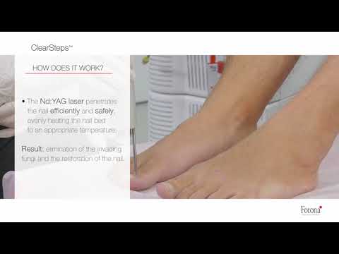 Video: Glivična Okužba Kože (Malassezia Pachydermatis) Kože Pri Psih
