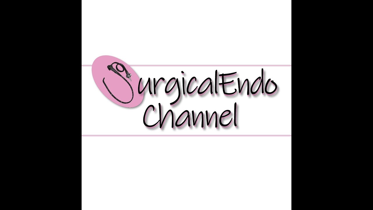 Endoloop by Surgicalendo Channel YouTube