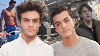 Where the Dolan Twins Are Now and Why They Quit