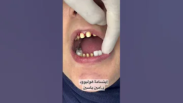 إبتسامة هوليوود د أمين ياسين Dreminyasin د أمين ياسين 