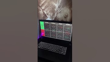 Trading📊📈 #coding #python #trading #forex #crypto #funny #comment #currencyexchange #forex #fyp