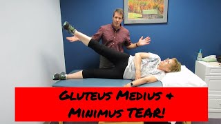 Gluteus Medius and Minimus tear vs. Greater Trochateric Bursitis