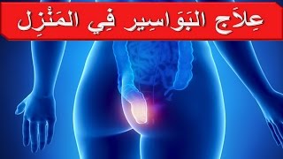 مرض البواسير الشرجية الداخلية والخارجية.علاج وطرق خلطات وصفات سهلة فعالة دون عمليات جراحة البواسير