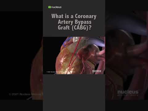 What is a Coronary Artery Bypass Graft (CABG)? #shorts