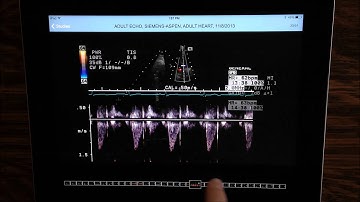 ShowCase Viewer for iPad Demo