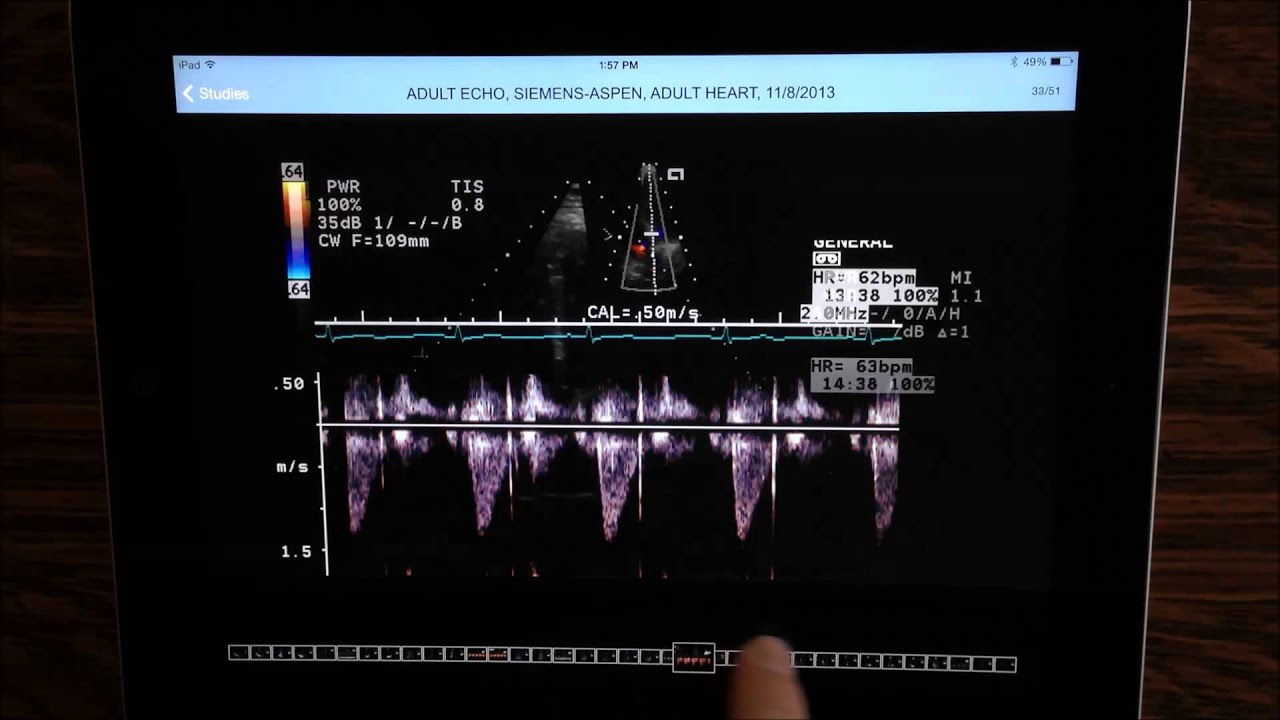 free dicom viewer ipad free dicom viewer ipad