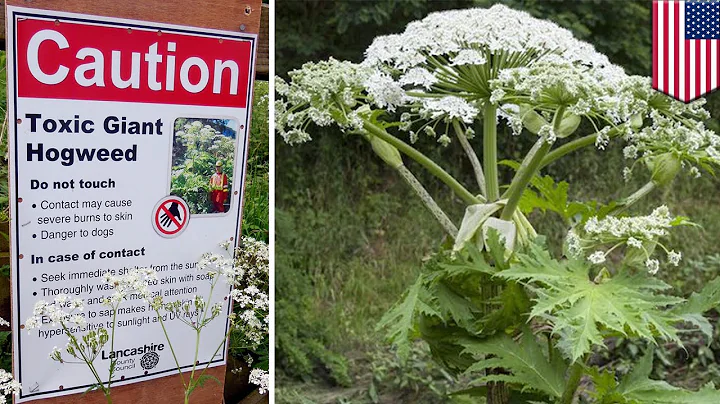 Giant hogweed found in Virginia can cause burns, b...