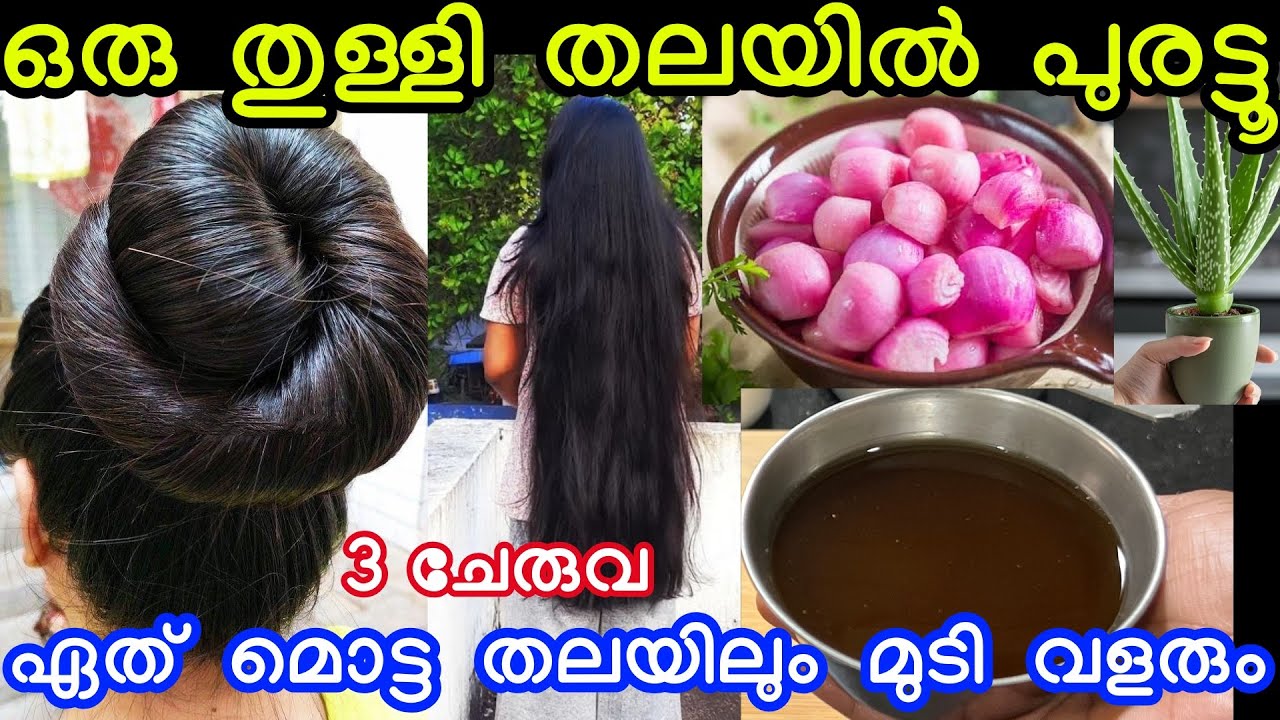 ഒരു തുള്ളി തലയിൽ പുരട്ടൂ വെറും 3 ചേരുവ ഏത് മൊട്ട തലയിലും മുടി കിളർത്ത് പനക്കുല പോലെ വളരും