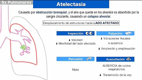 ¿Qué es el síndrome del pulmón húmedo?