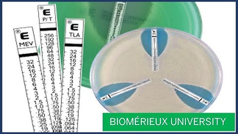 ETEST: Use of Forceps to Apply Strips