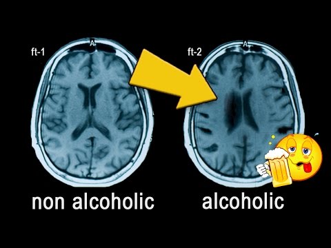 Video: Debunking Alkohol Myter